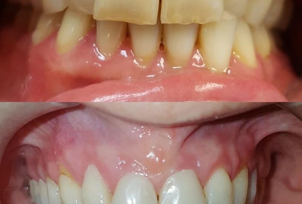 Cosmetic Dentistry 3