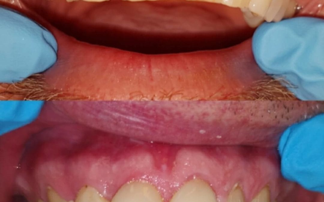 Cosmetic Dentistry 3x