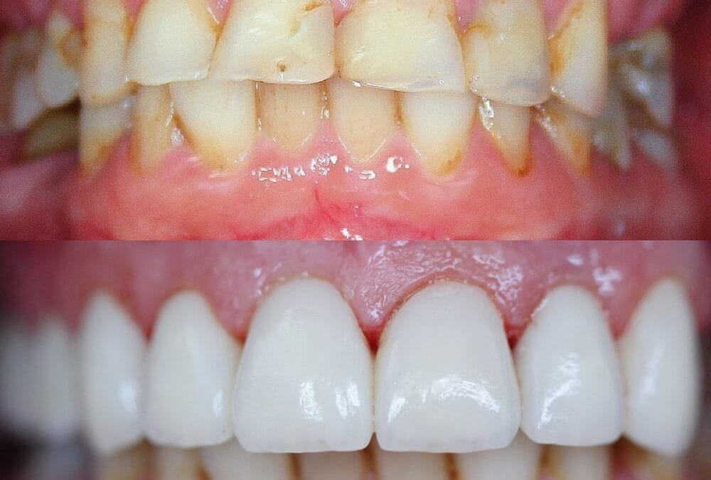 Cosmetic Dentistry 1