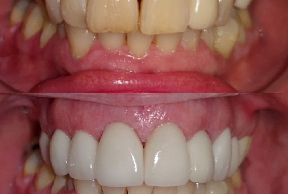 Cosmetic Dentistry 9