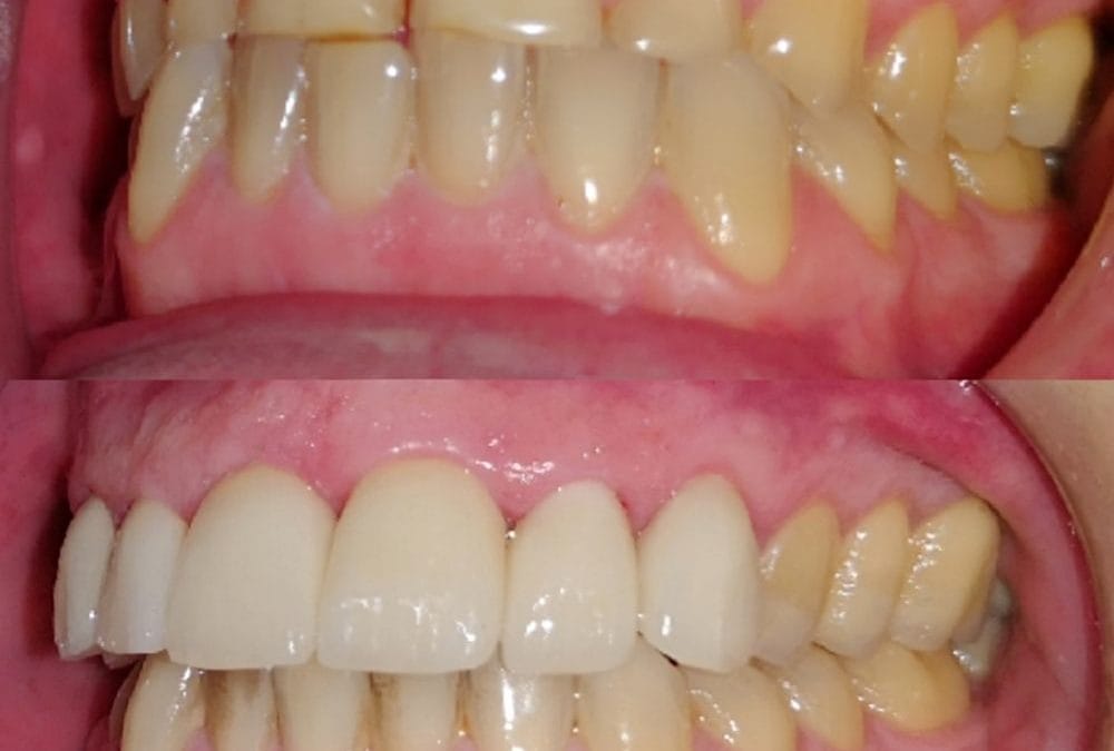 Cosmetic Dentistry 6