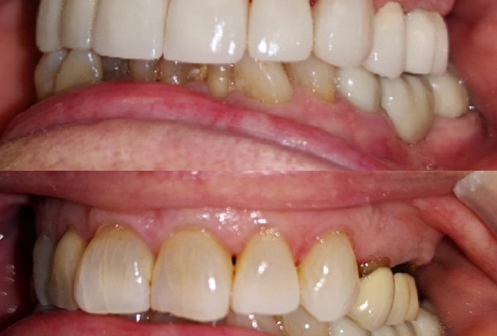 Cosmetic Dentistry 8