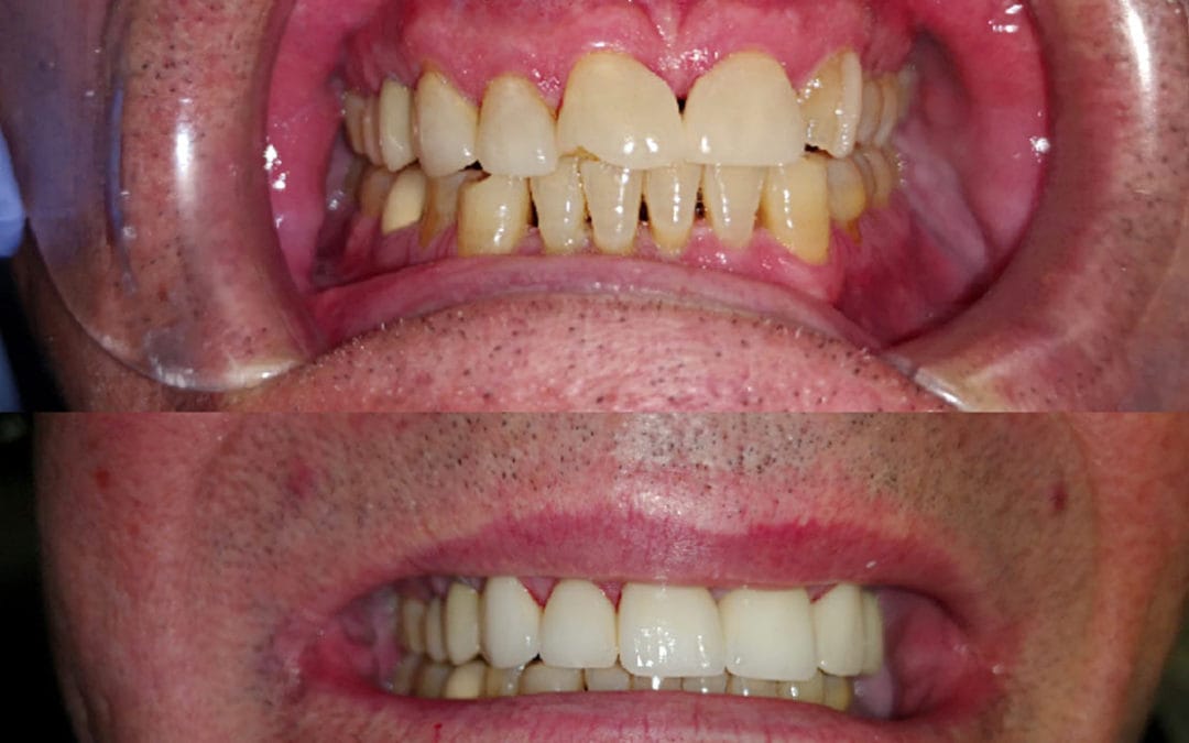 Cosmetic Dentistry 12