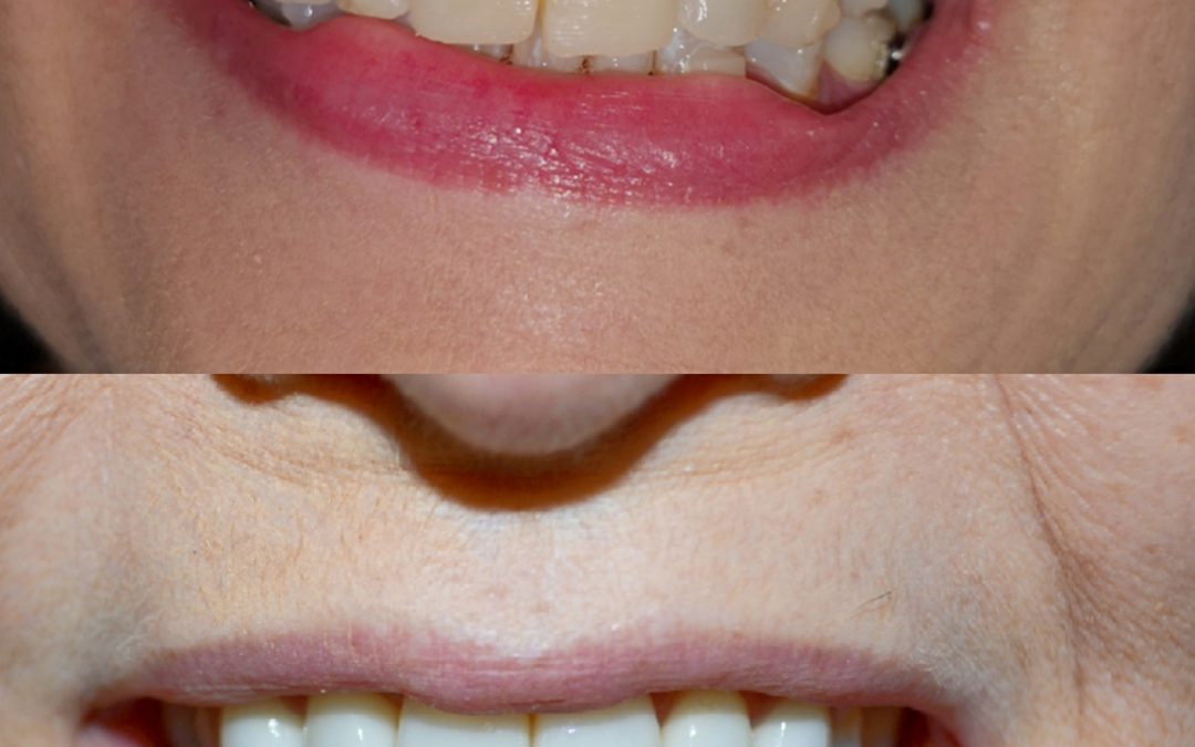 Cosmetic Dentistry 13