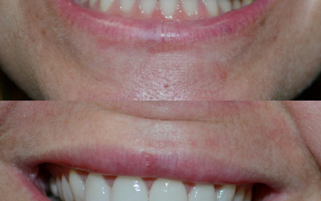 Cosmetic Dentistry 5