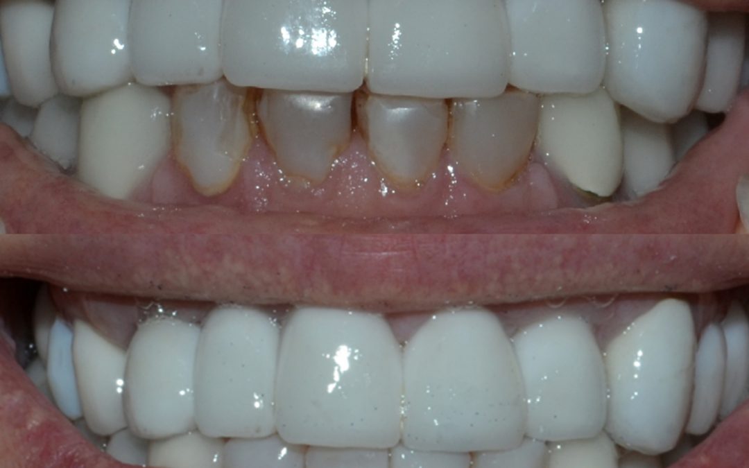 Cosmetics Dentistry