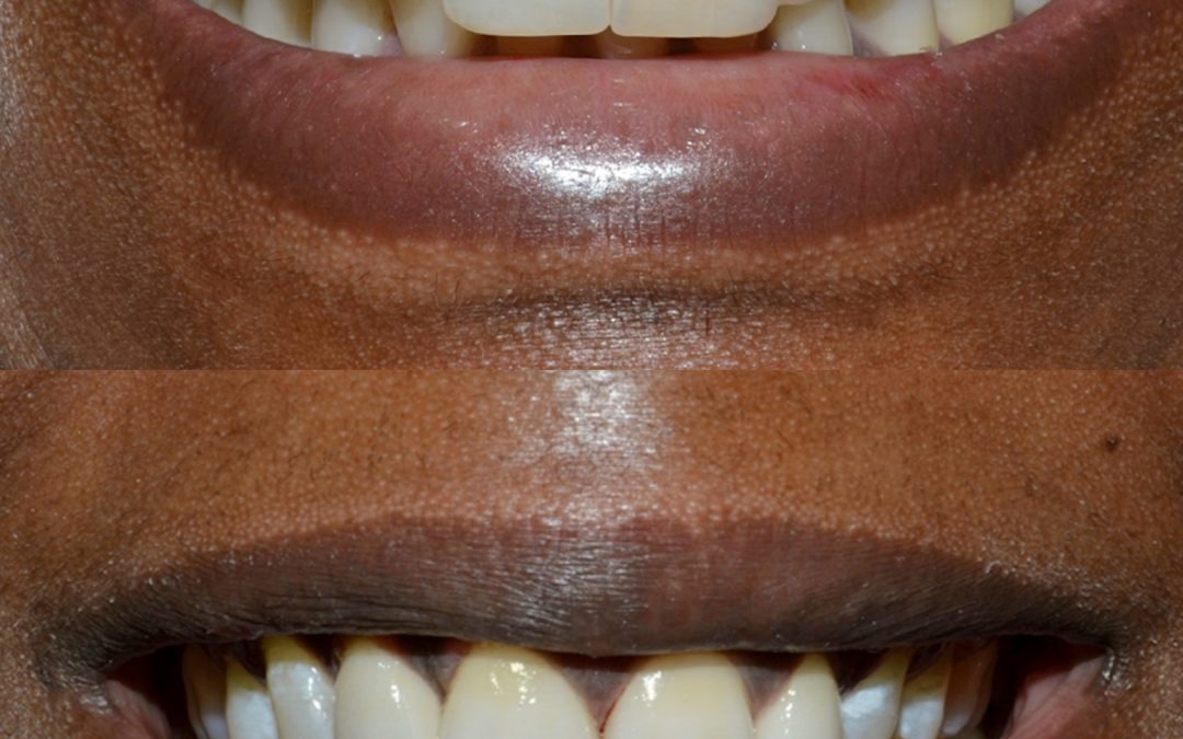 Cosmetics Dentistry 20