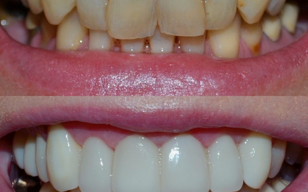 Cosmetics Dentistry 22