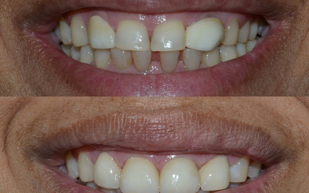Cosmetics Dentistry 24