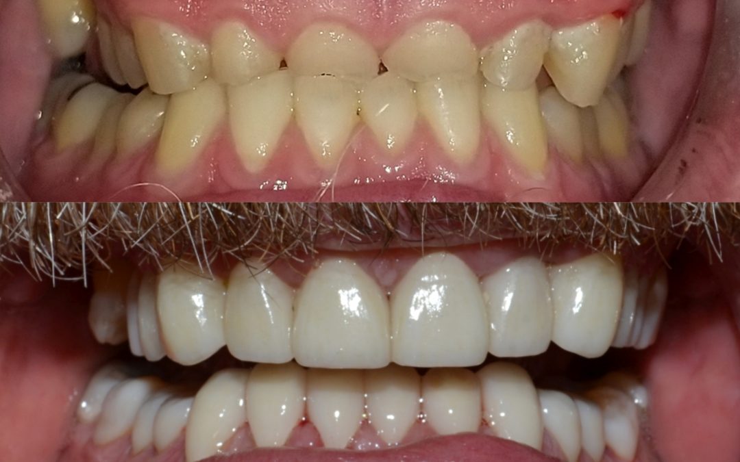 Cosmetic Dentistry 28