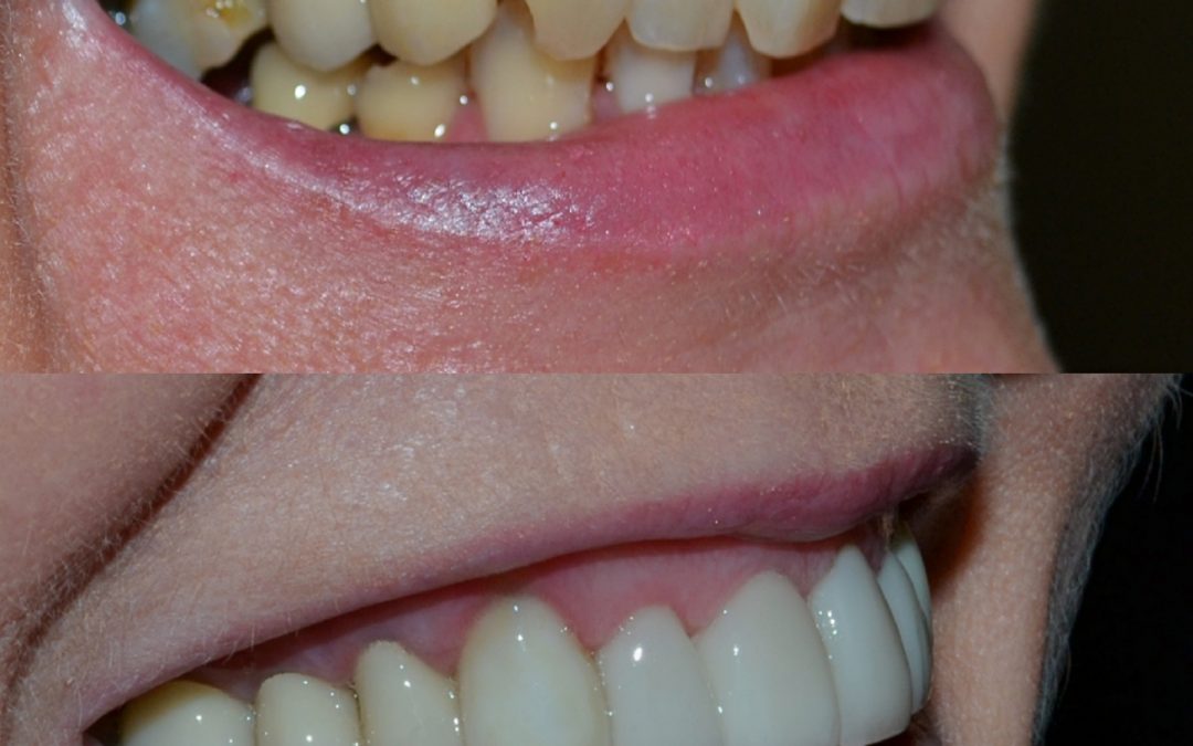 Cosmetic Dentistry 30