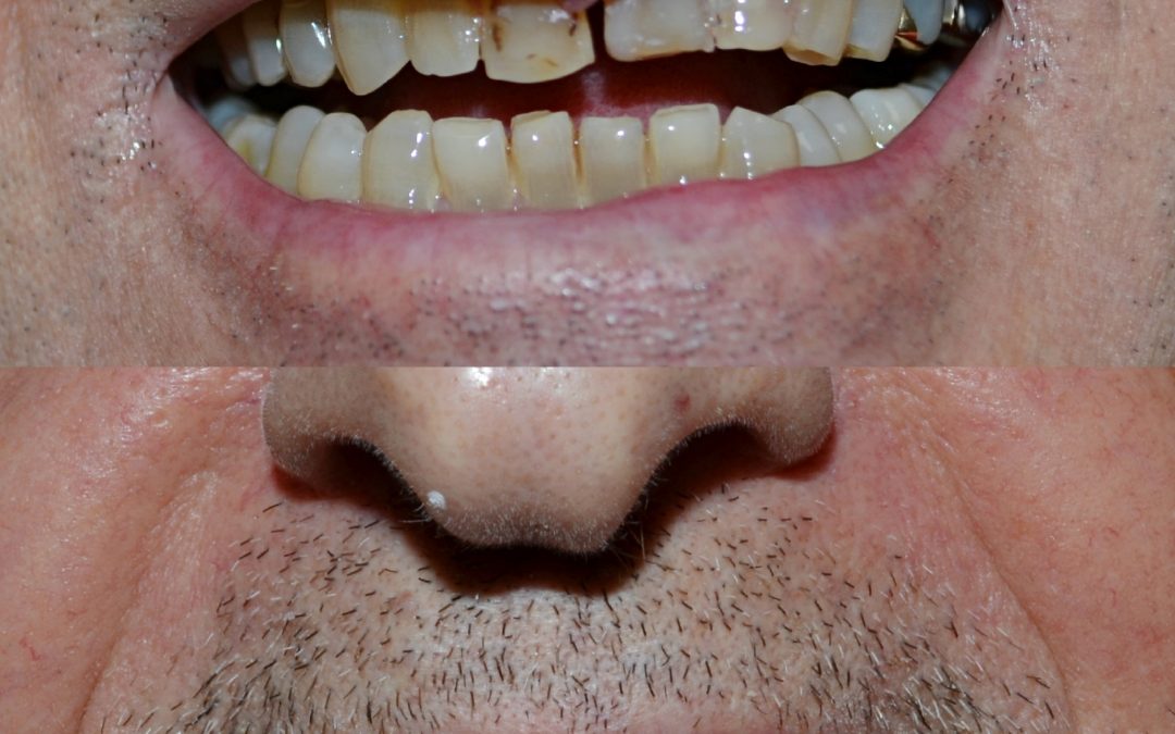 Cosmetic Dentistry 26
