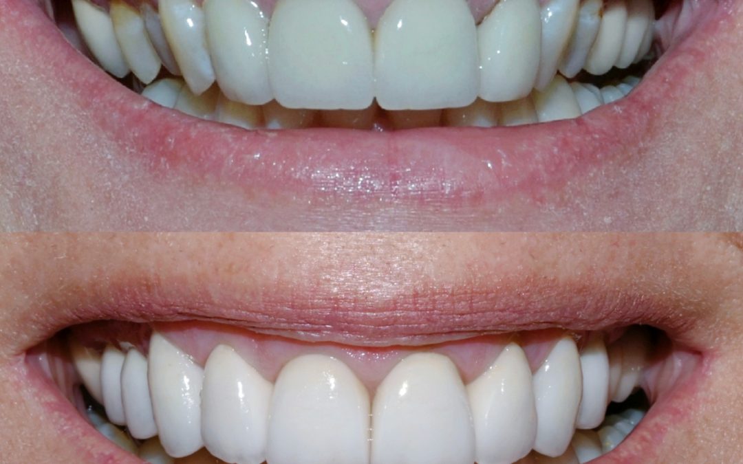 Cosmetic Dentistry 27