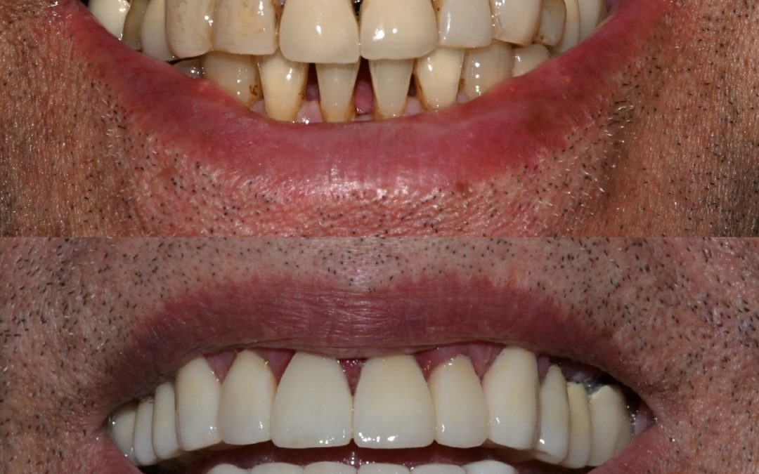 Cosmetic Dentistry 31