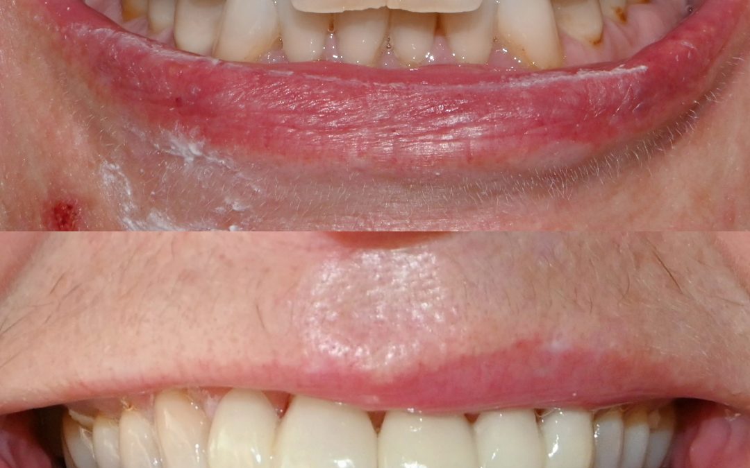Cosmetic Dentistry 32