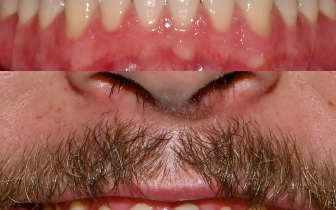 Cosmetic Dentistry 33