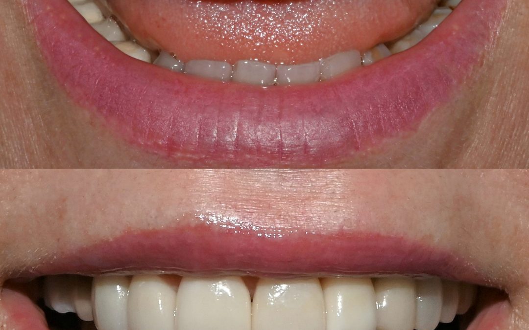 Cosmetic Dentistry 34