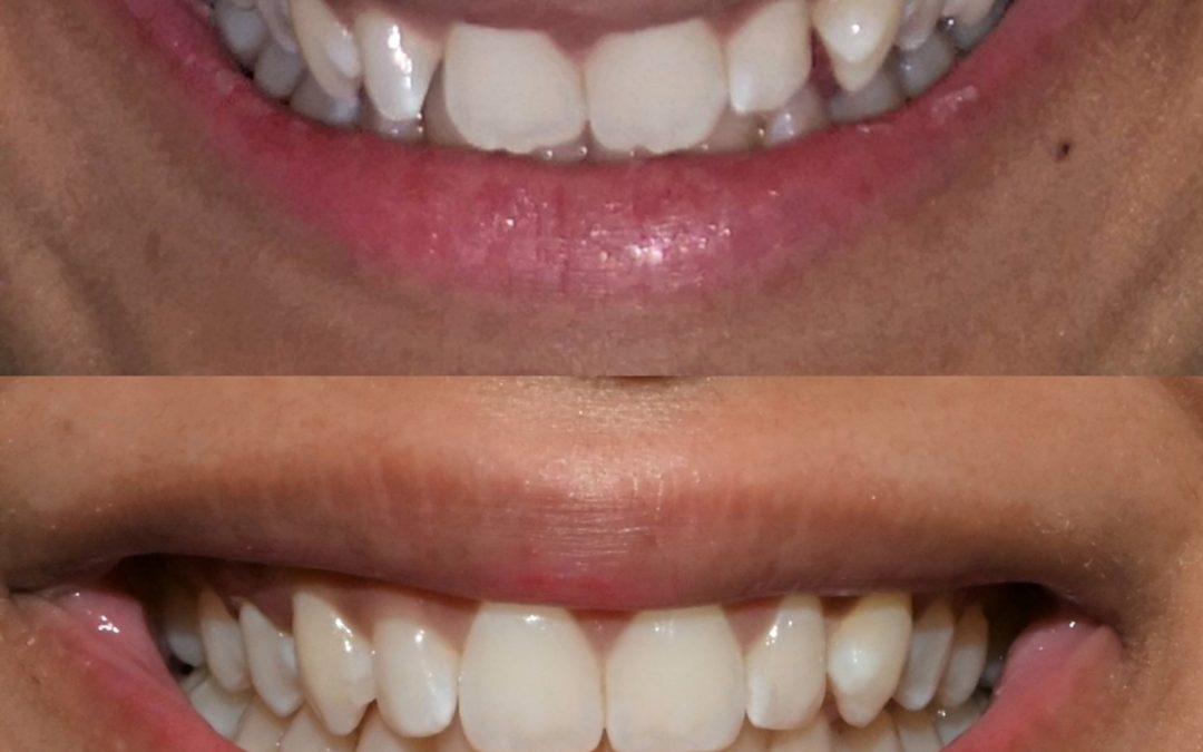 Orthodontics 01