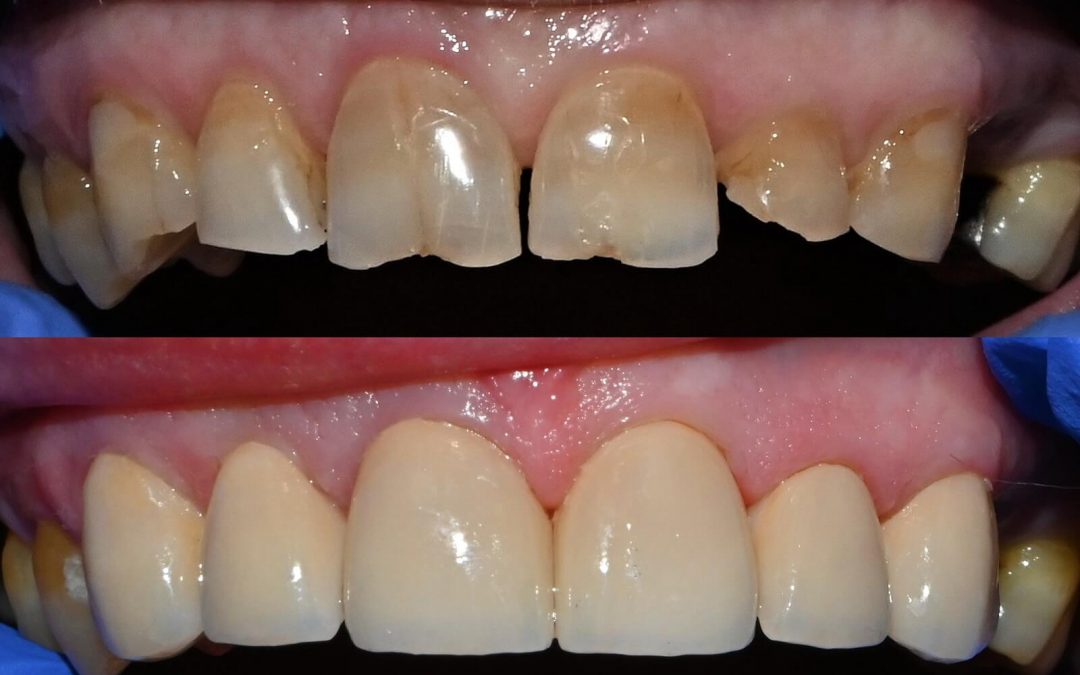 Cosmetic_Dentistry