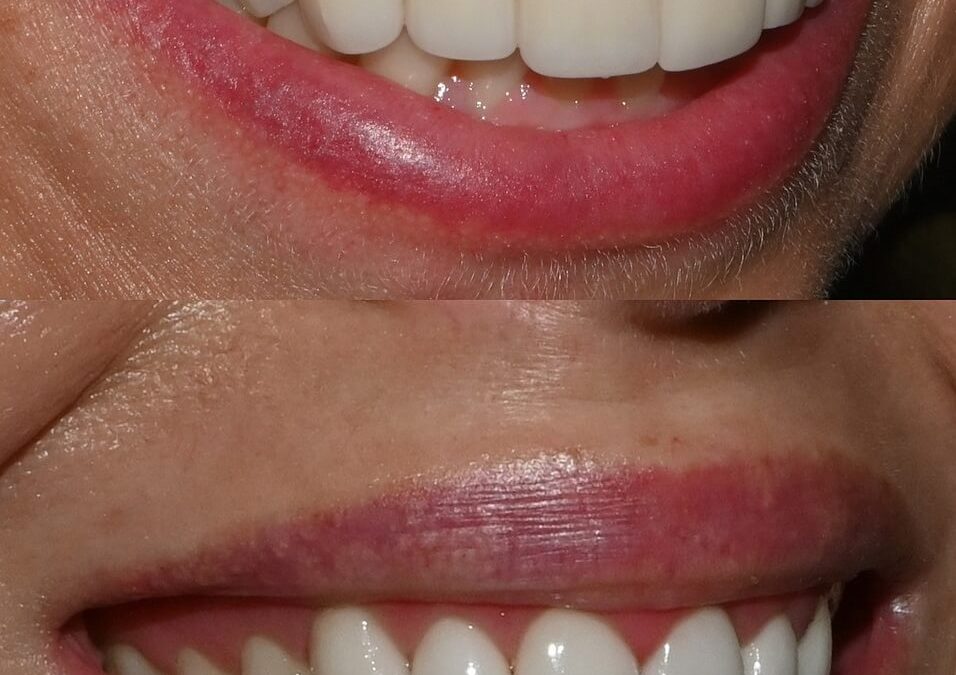 Cosmetic_Dentistry_3