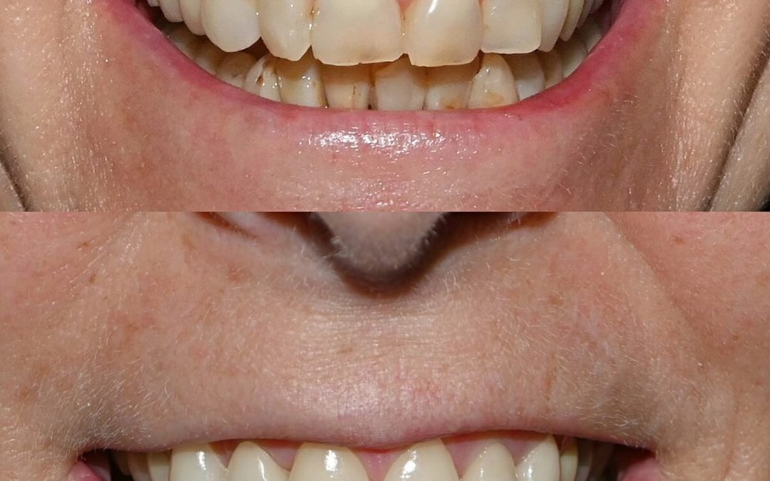 Cosmetic_Dentistry_4