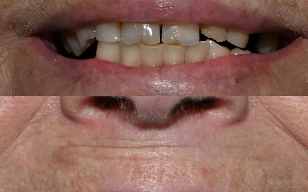 Cosmetic_dentistry_2