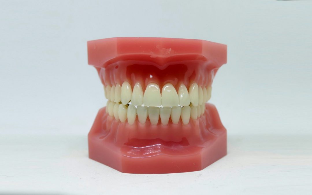 How Can Enamel Loss Be Fixed